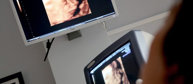 רשלנות רפואית בהריון – מהי ולמה חשוב לשים לב?